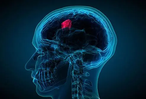Head and Neck Cancer Treatment in Shivaji Nagar