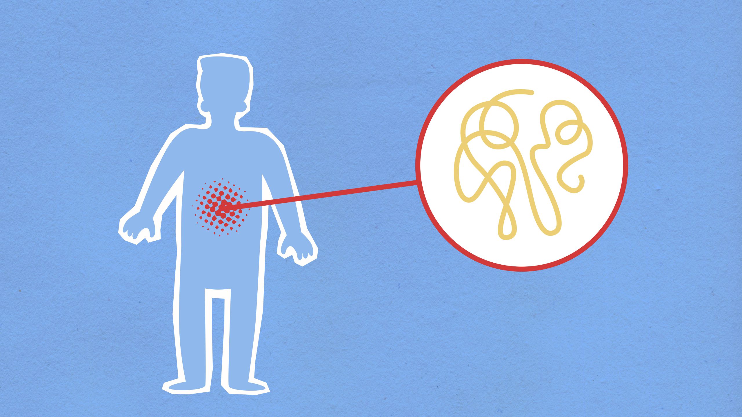 GI Cancer Doctor in Shivaji Nagar